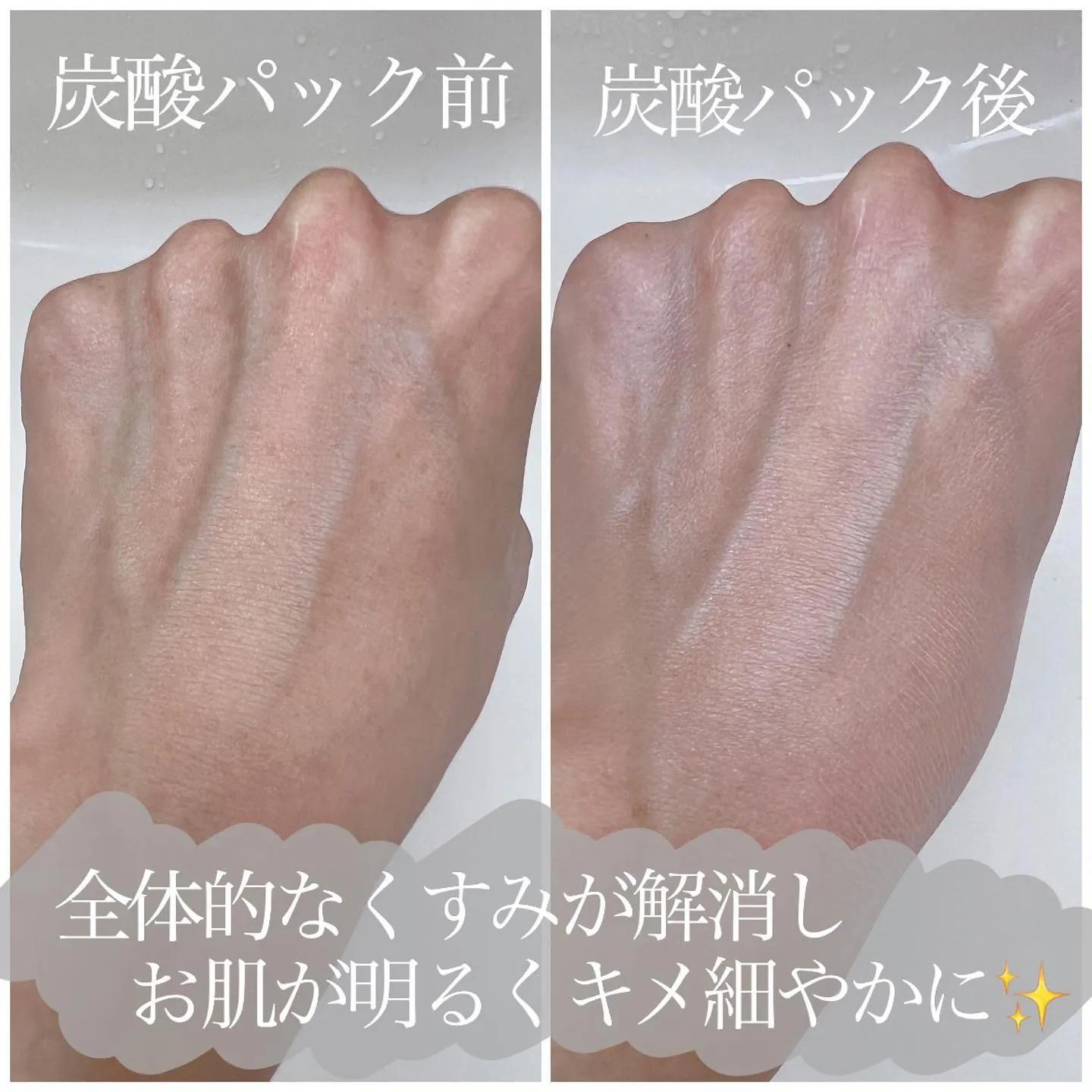 ＼　炭酸パックってどんなもの？　／