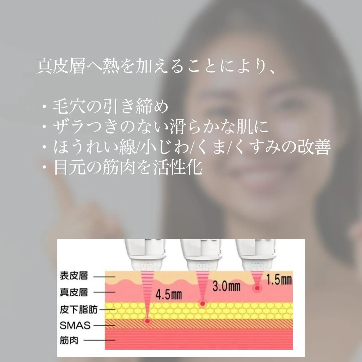 ＼　くま・たるみ・ほうれい線の原因って？　／