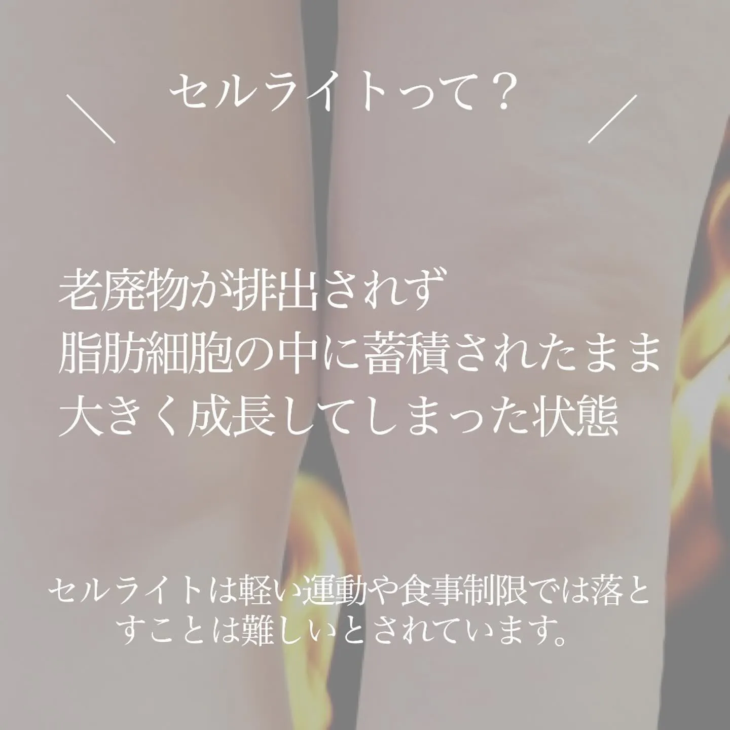 ＼　セルライトって何？　／